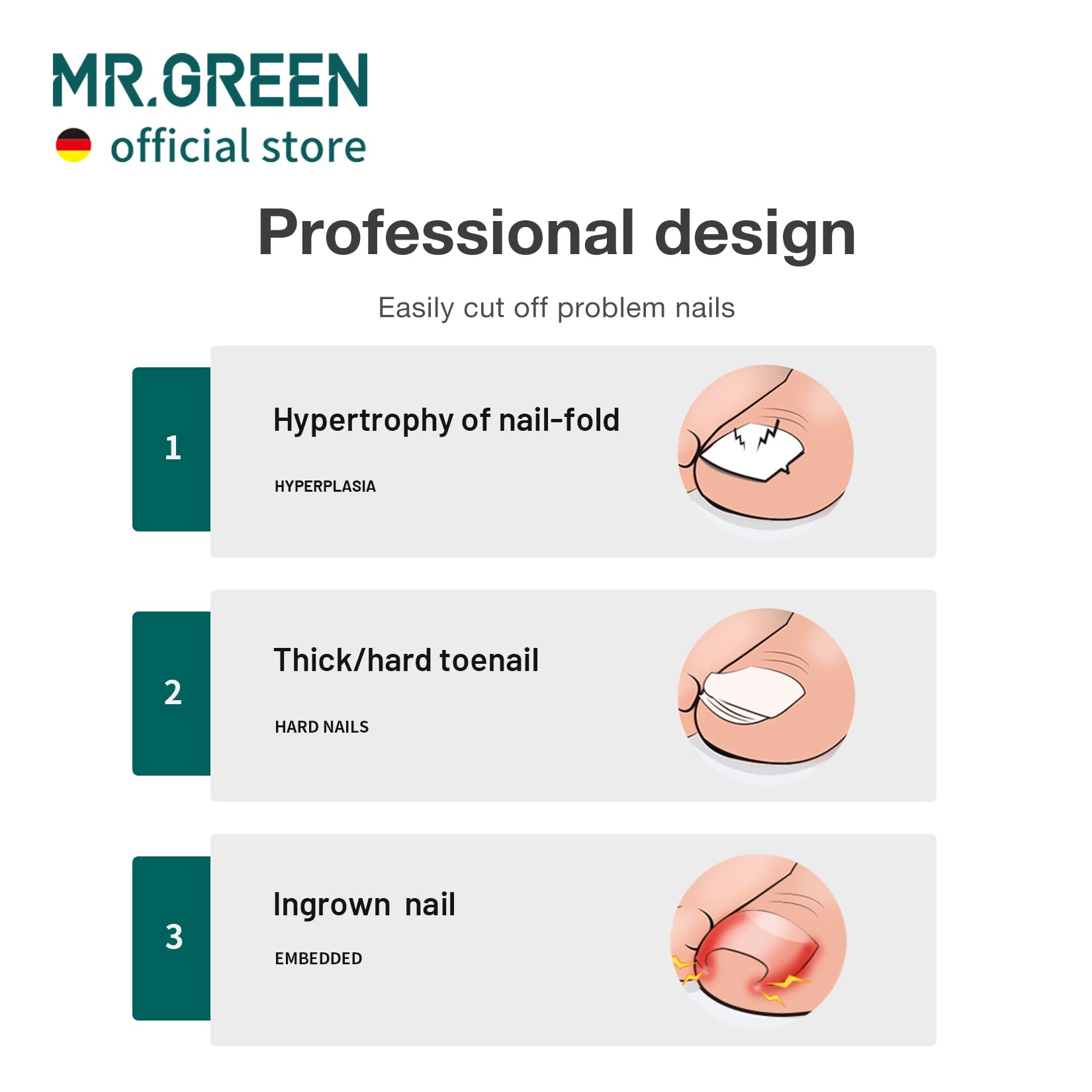 MR.GREEN toenail clippers 25-degree angled blades for safer deep trimming
