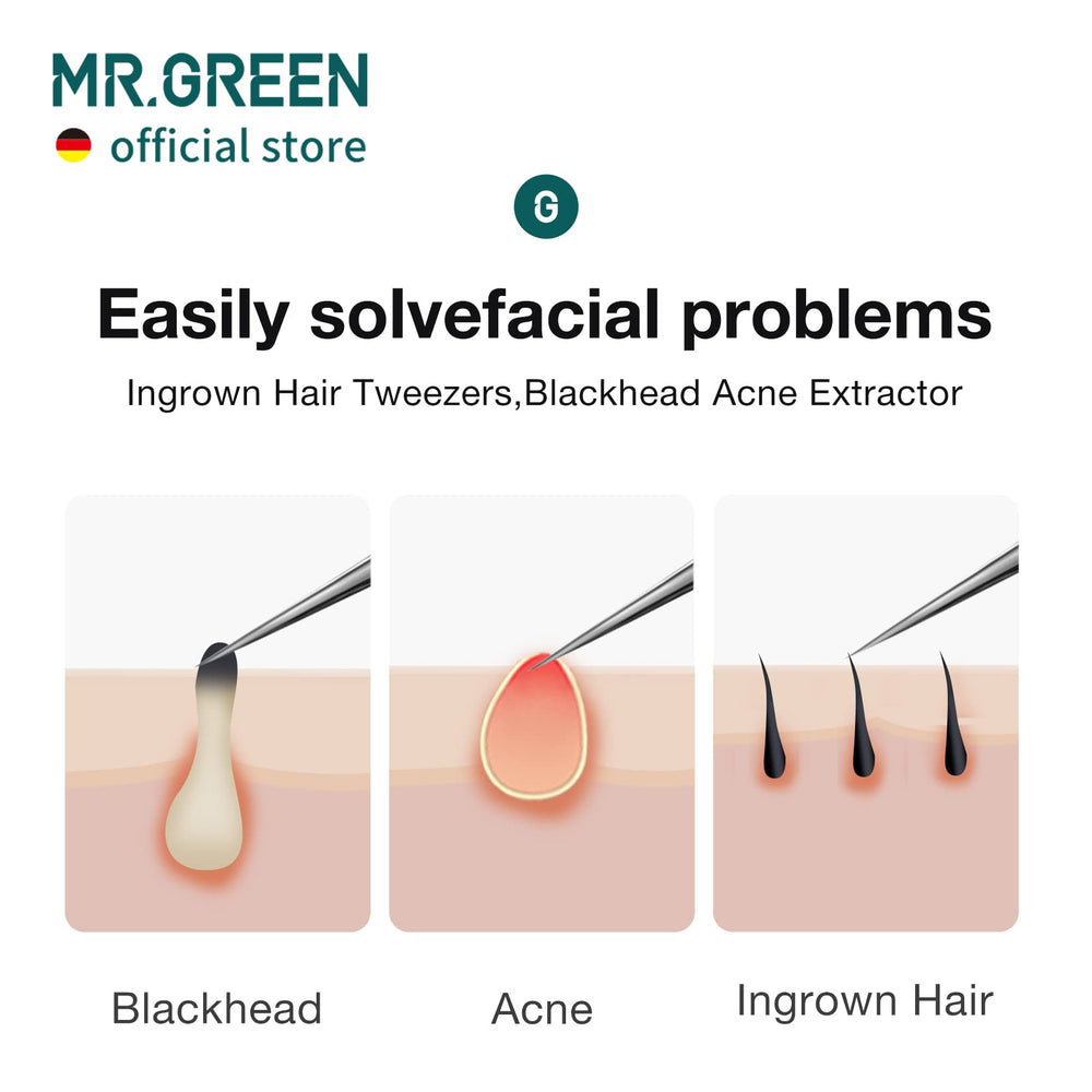 MR.GREEN tweezers feature German precision engineering for consistent tip closure.
