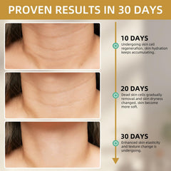 MUOCOBU wrinkle-reduction closeup hints at smoother neck lines.