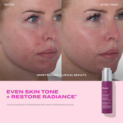 Murad bilberry-seed-oil from berries provides omegas for healthy skin barrier