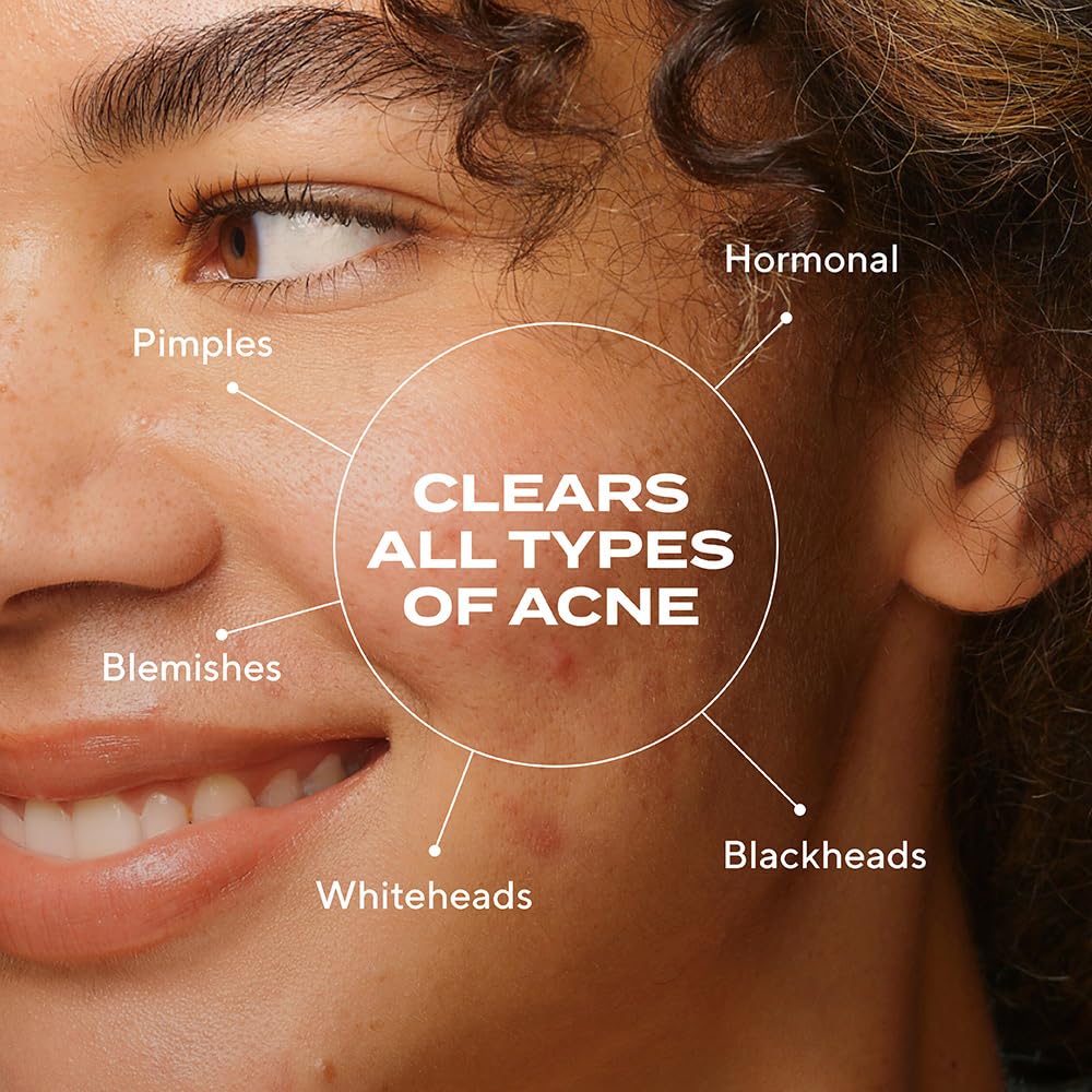Murad Biome-Balancing Acne Serum dropper for precise, gentle application.