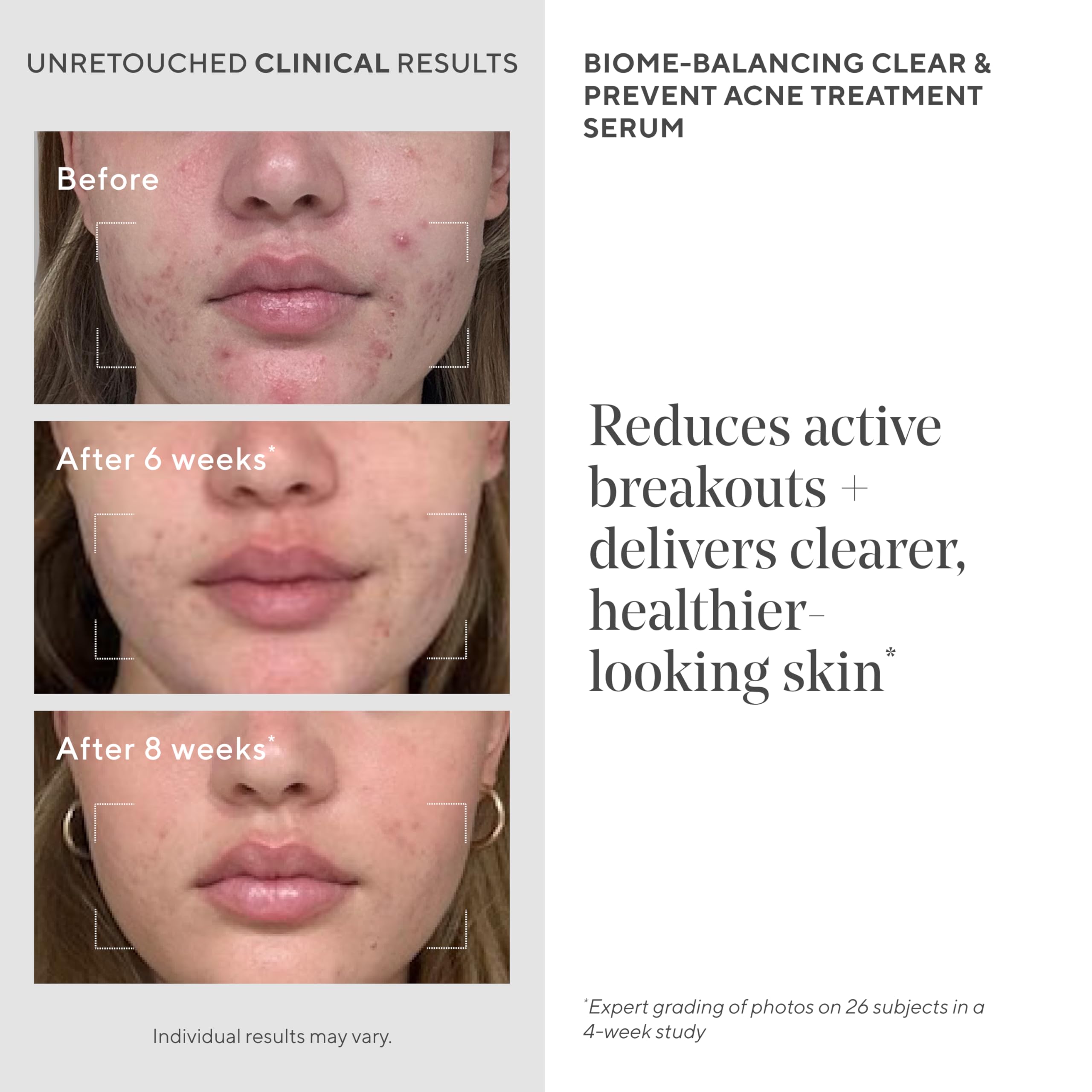 Murad Biome-Balancing Acne Serum ingredients image highlights glutamic, mandelic, and salicylic acids.