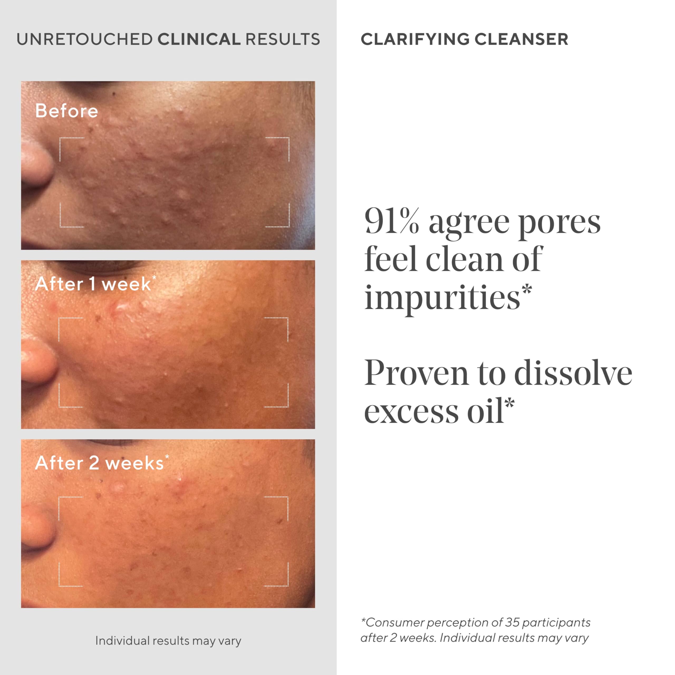 Murad Clarifying Cleanser gel texture close-up emphasizes refreshing cleansing experience.