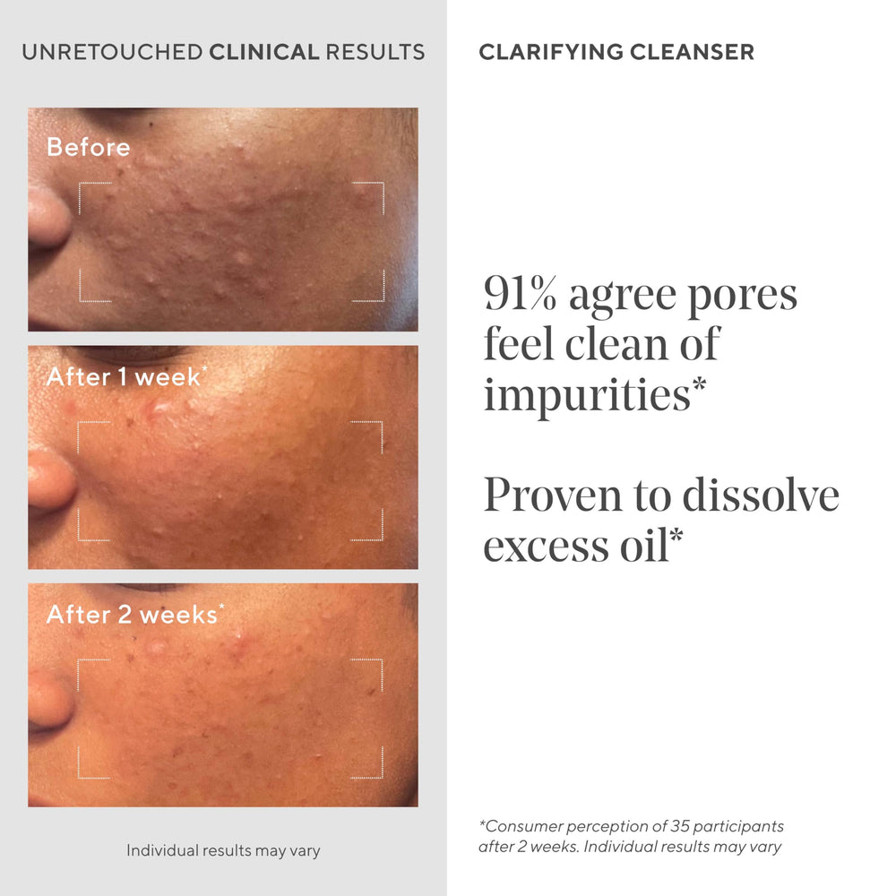 Murad Clarifying Cleanser gel texture close-up emphasizes refreshing cleansing experience.