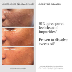 Murad Clarifying Cleanser gel texture close-up emphasizes refreshing cleansing experience.