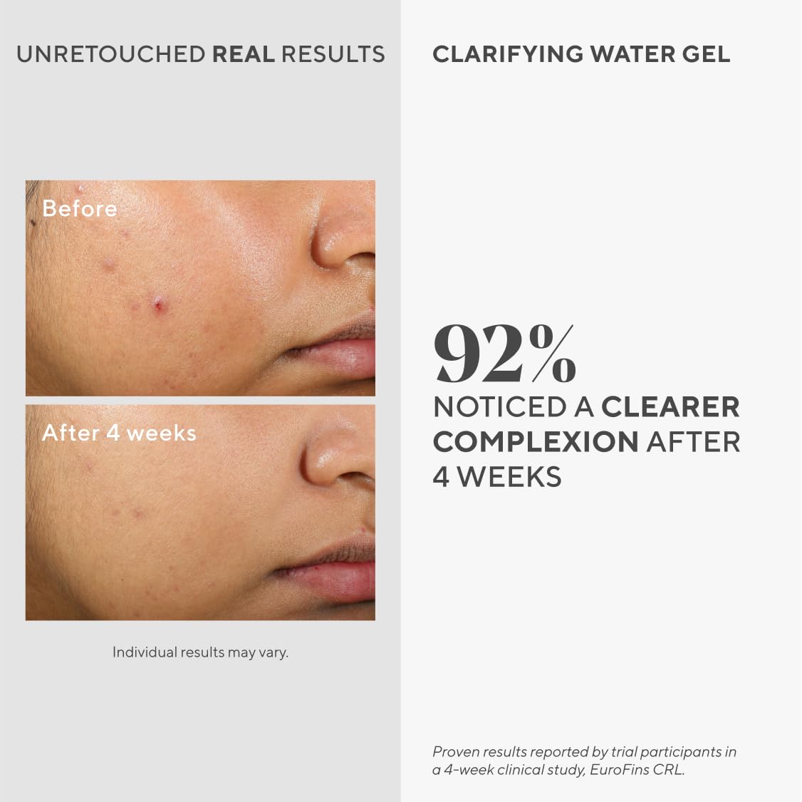 Murad Clarifying Water Gel texture applied to skin for lightweight shine-free hydration.