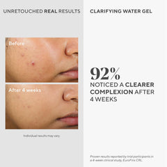 Murad Clarifying Water Gel texture applied to skin for lightweight shine-free hydration.