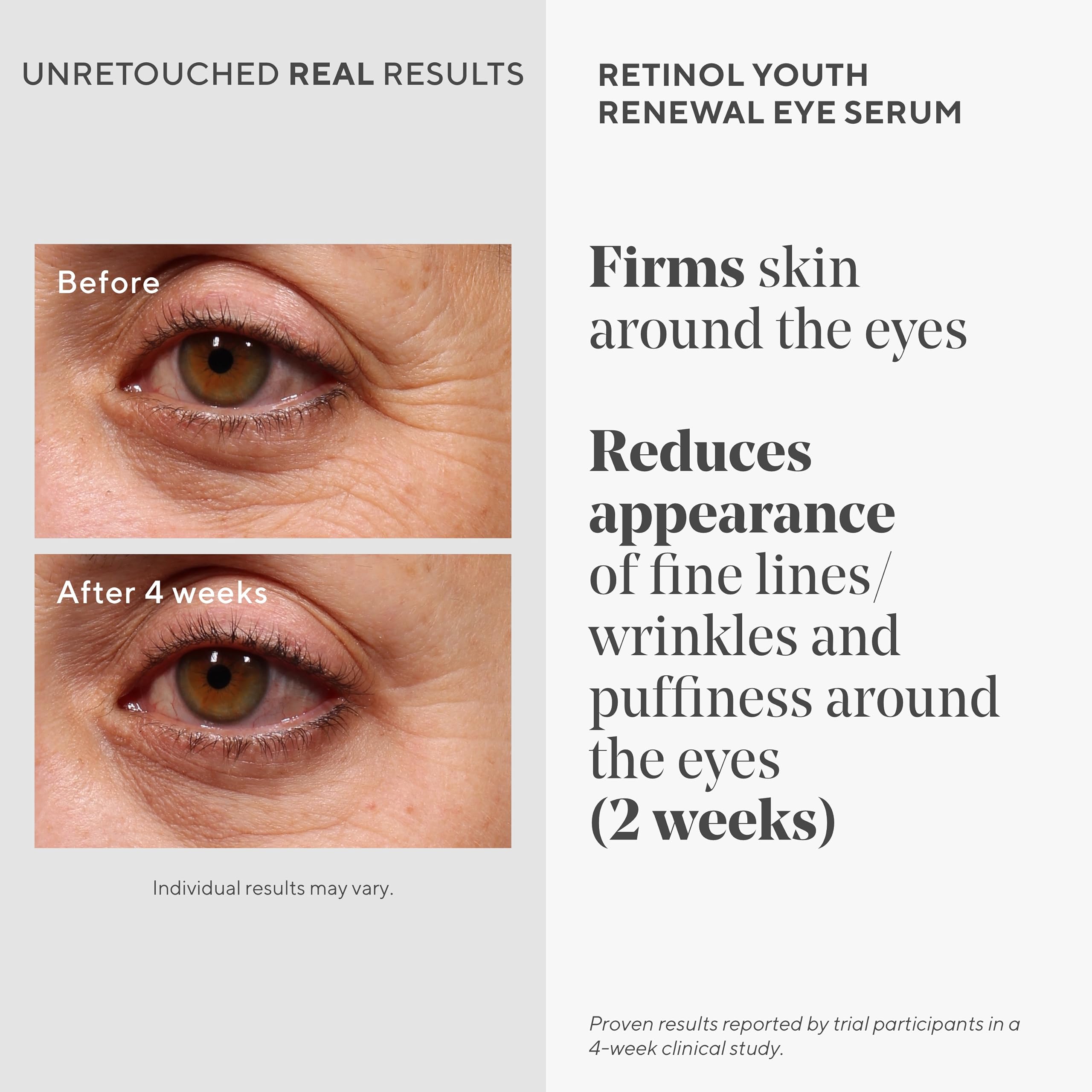 Murad eye serum packaging label highlighting gentle retinol formula for sensitive skin
