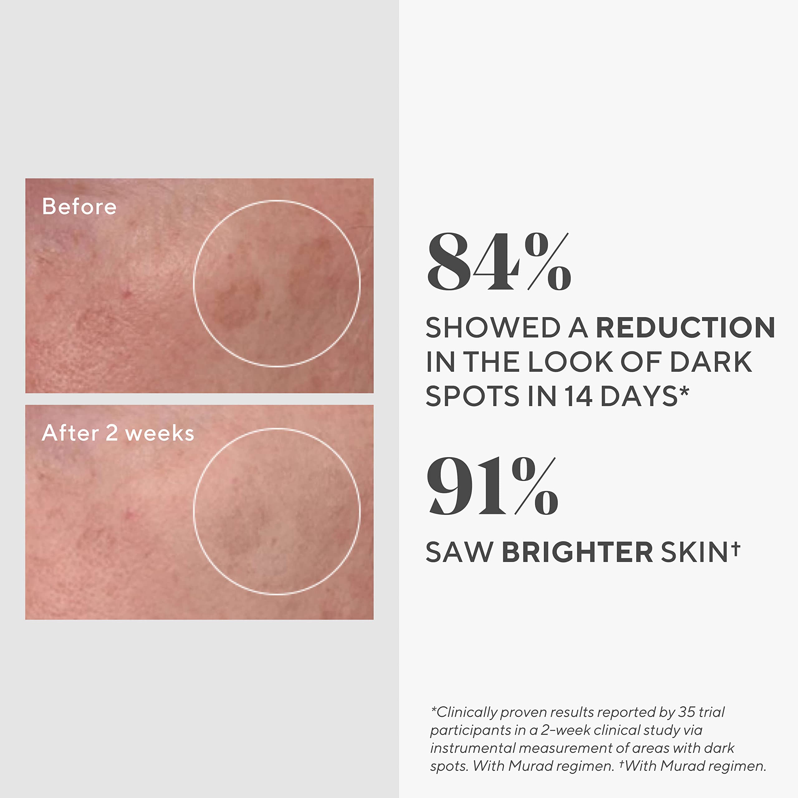 Murad Rapid Dark Spot Serum application-on-cheek demonstrates glycolic-acid resurfacing for even skin