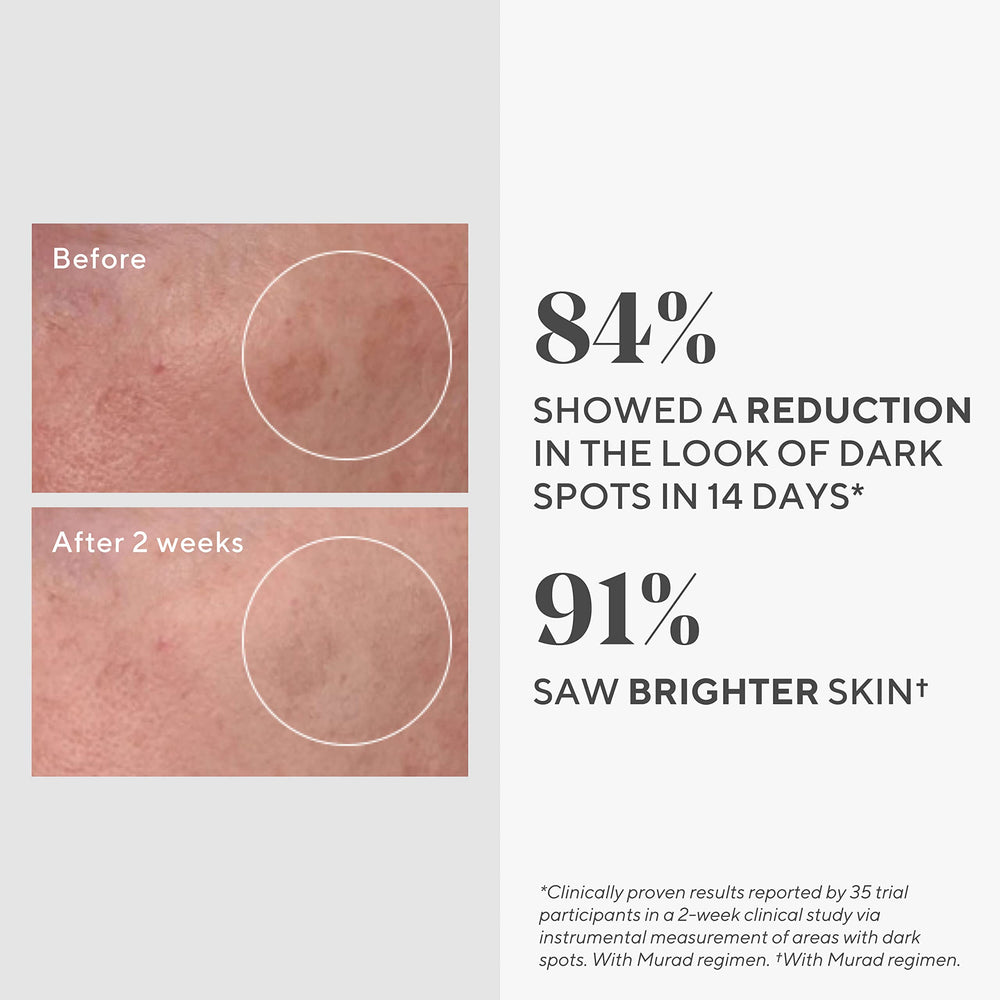 Murad Rapid Dark Spot Serum application-on-cheek demonstrates glycolic-acid resurfacing for even skin