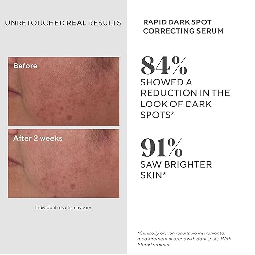 Murad Rapid Dark Spot Serum packaging emphasizes clean formulation for daily use.
