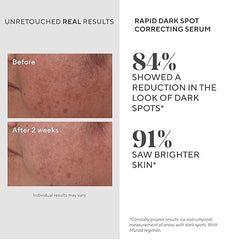 Murad Rapid Dark Spot Serum packaging emphasizes clean formulation for daily use.