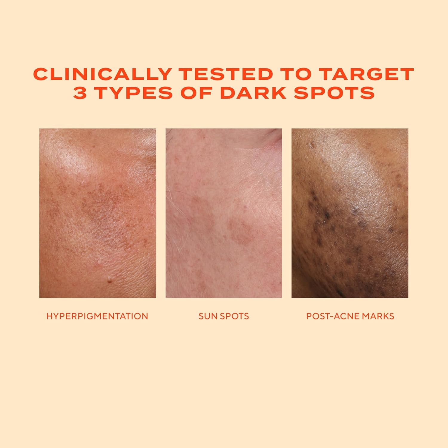 Murad Rapid Dark Spot Serum label notes tranexamic acid for brightening action.