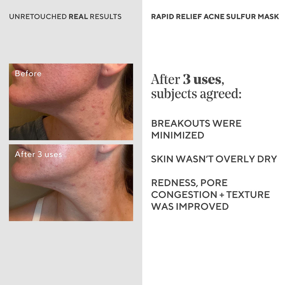 Murad mask bottle with Austrian peat highlight for calming redness.