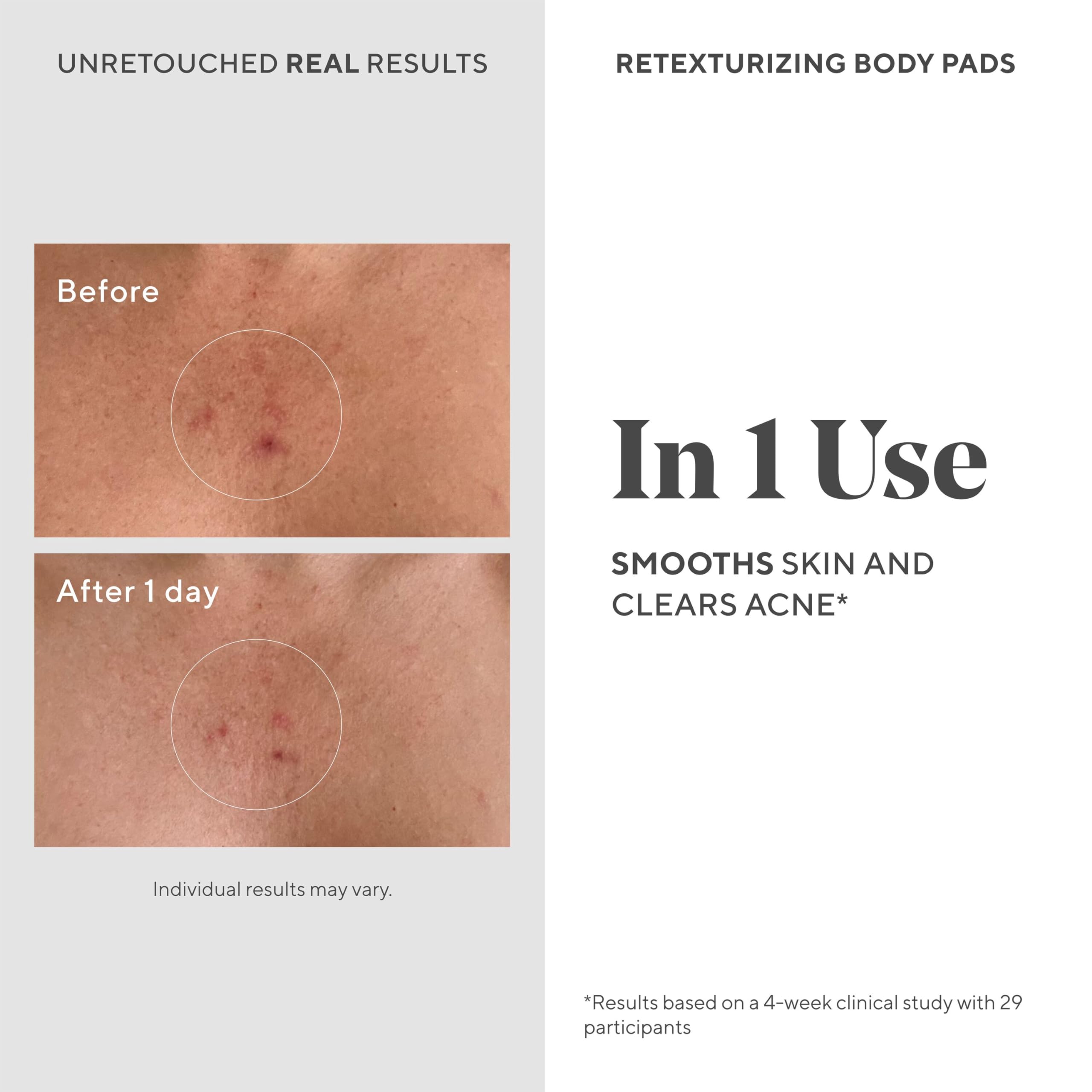 Murad Retexturizing Body Pads open pack flatlay emphasizes biodegradable, oil-free hydration with acids