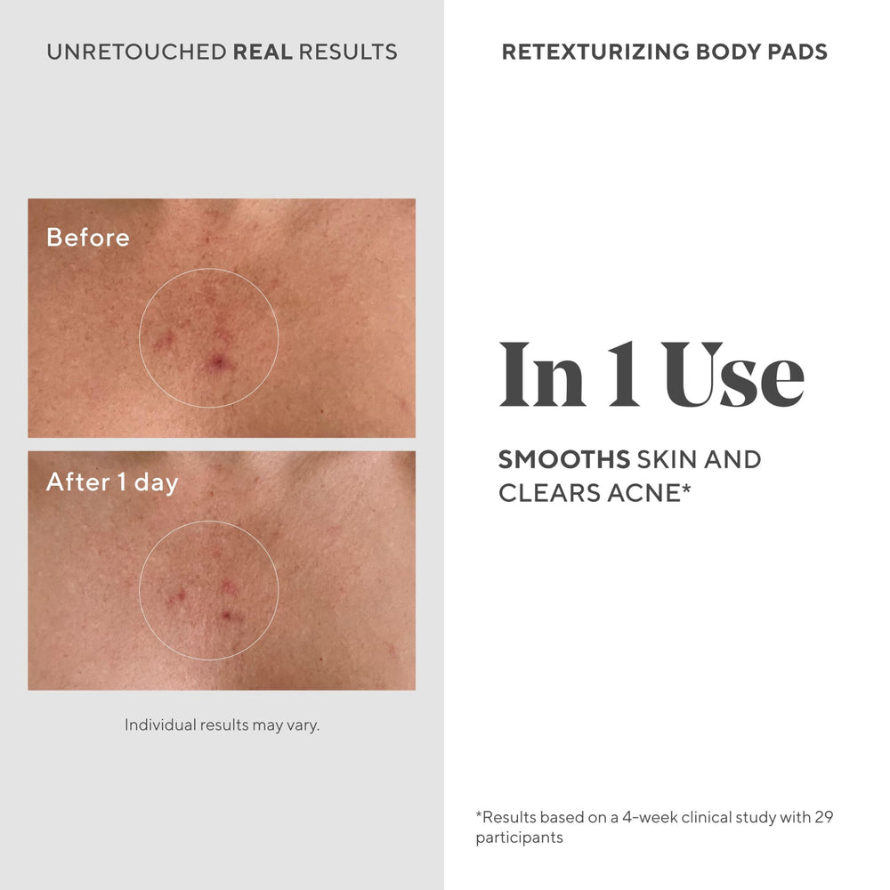 Murad Retexturizing Body Pads open pack flatlay emphasizes biodegradable, oil-free hydration with acids