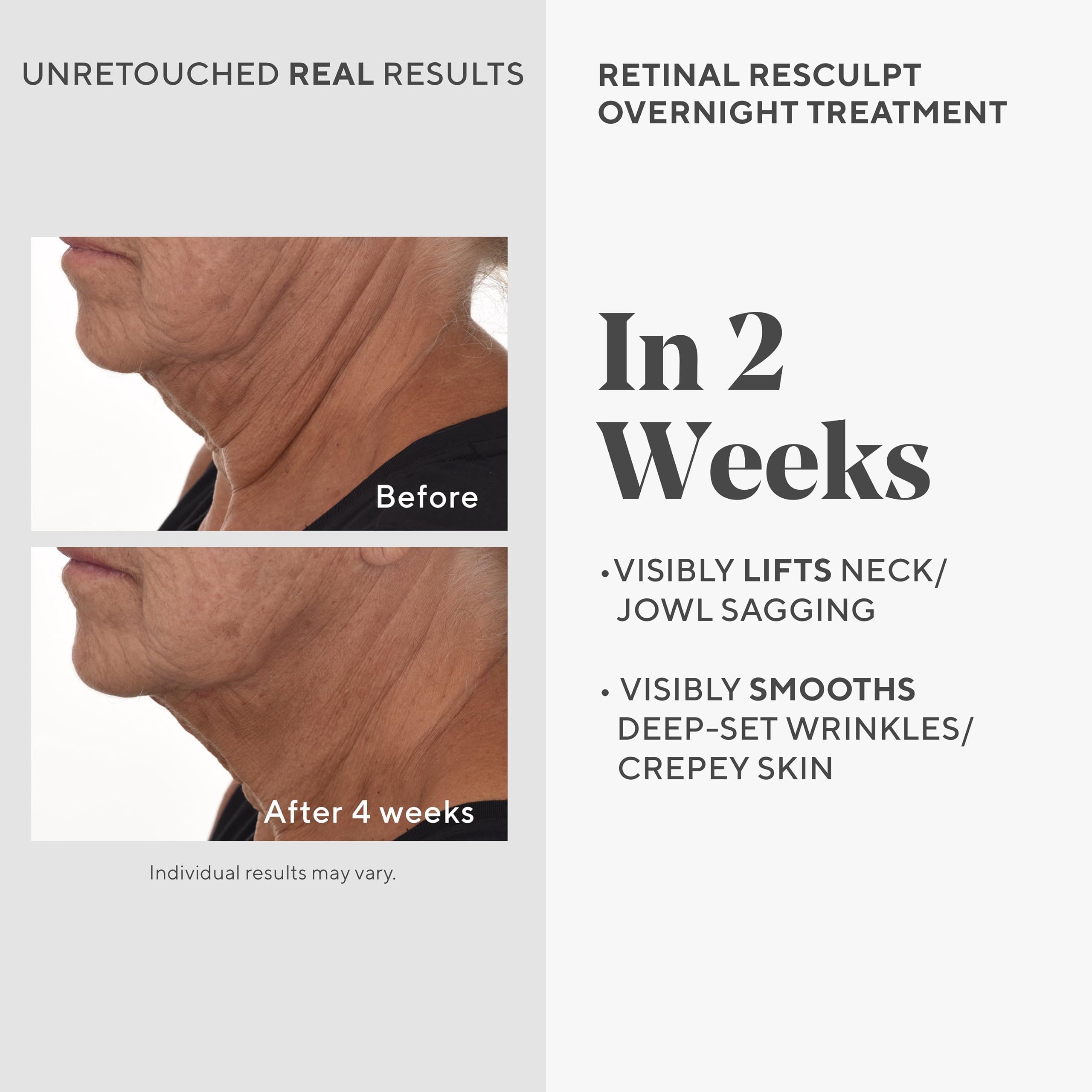 Murad Retinal ReSculpt encapsulated retinal detail illustrating deep delivery concept.