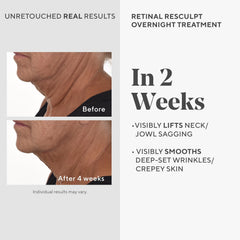 Murad Retinal ReSculpt encapsulated retinal detail illustrating deep delivery concept.