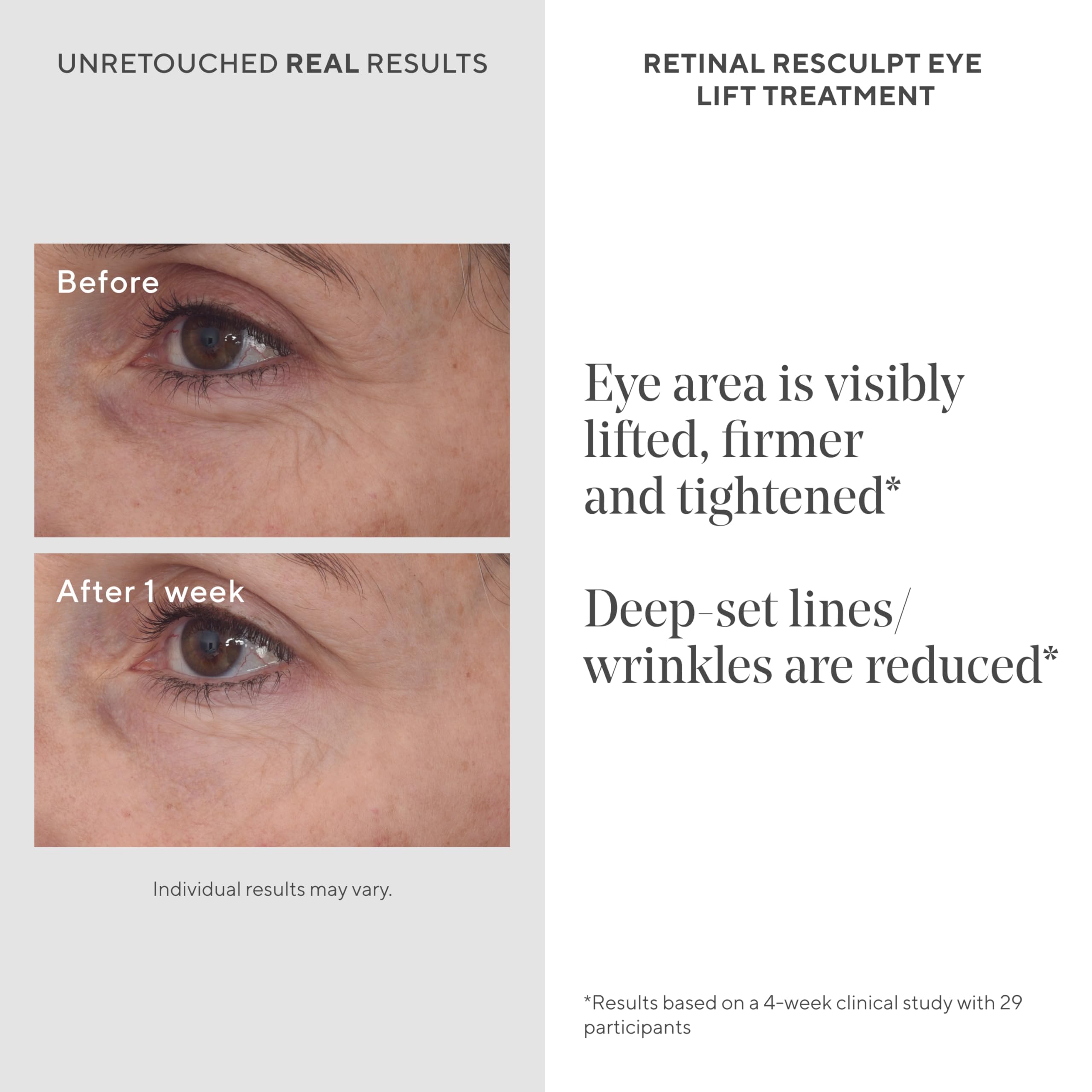 Murad Retinal ReSculpt Eye Lift Treatment under-eye application demonstrates targeted lift around the orbital area.
