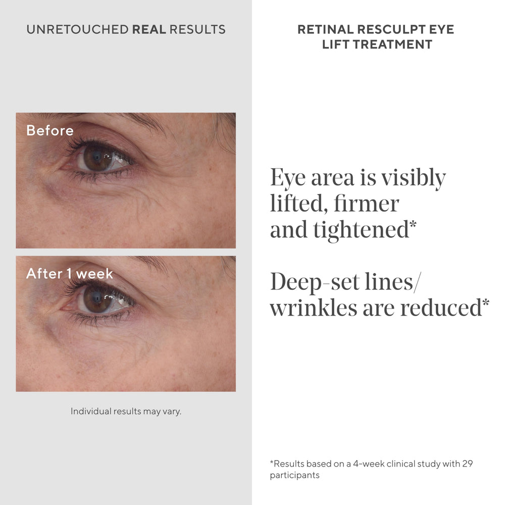 Murad Retinal ReSculpt Eye Lift Treatment under-eye application demonstrates targeted lift around the orbital area.