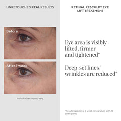 Murad Retinal ReSculpt Eye Lift Treatment under-eye application demonstrates targeted lift around the orbital area.