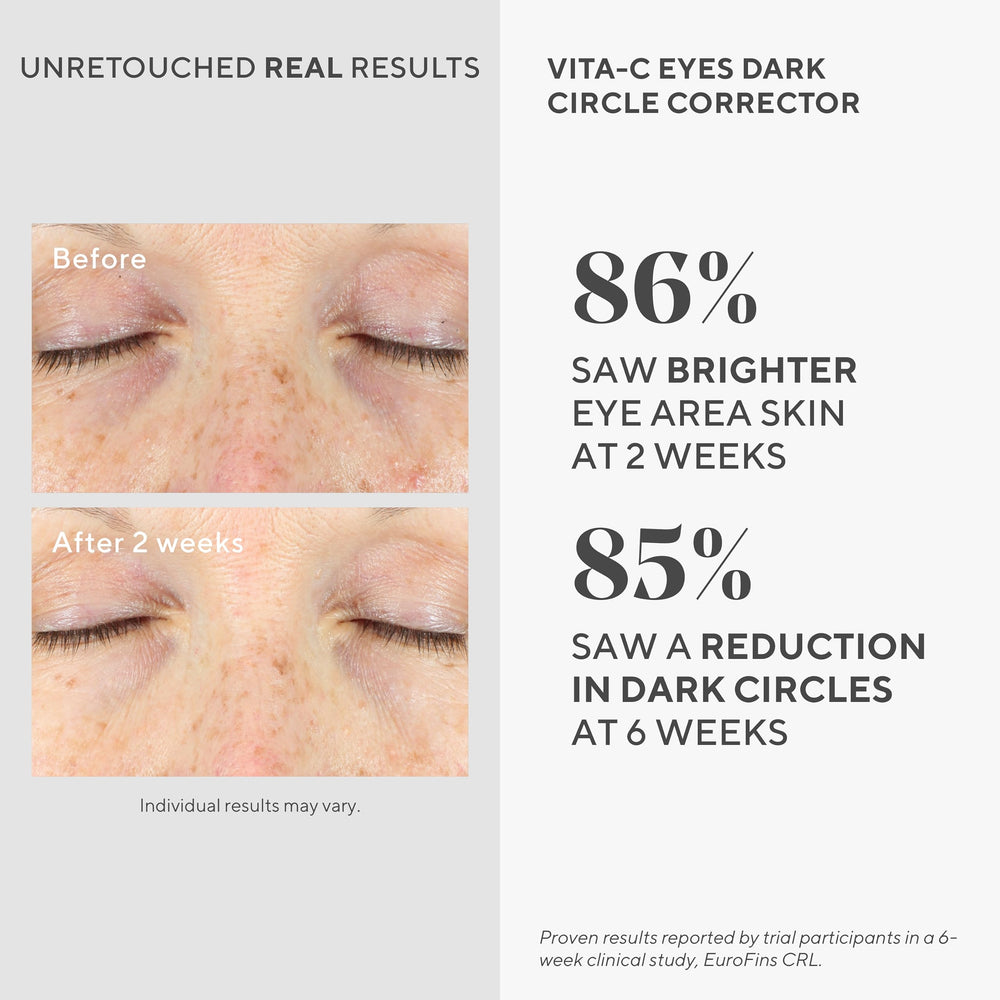 Murad Vita-C Eyes algae-ingredient-boost image suggesting nourishing eye care.