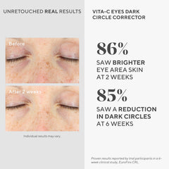 Murad Vita-C Eyes algae-ingredient-boost image suggesting nourishing eye care.