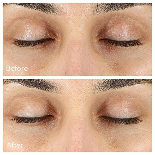 Murad Vita-C Eyes gold-stabilized vitamin C highlighting antioxidant support for brightness.
