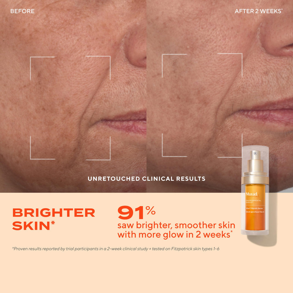 Murad Vita-C Glycolic Serum face application promotes even-toned, radiant skin.
