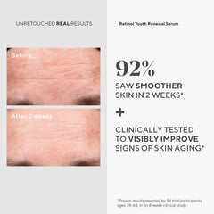 Murad Youth Renewal Eye Serum trial tube for smoother eye area