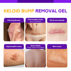 MURASAKI BEAUTY Keloid Bump Gel ingredients label highlights ceramides and hyaluronic acid.