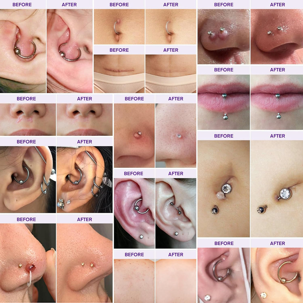 MURASAKI BEAUTY Keloid Bump Gel packaging shown for scar care product.
