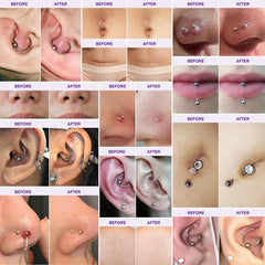 MURASAKI BEAUTY Keloid Bump Gel packaging shown for scar care product.