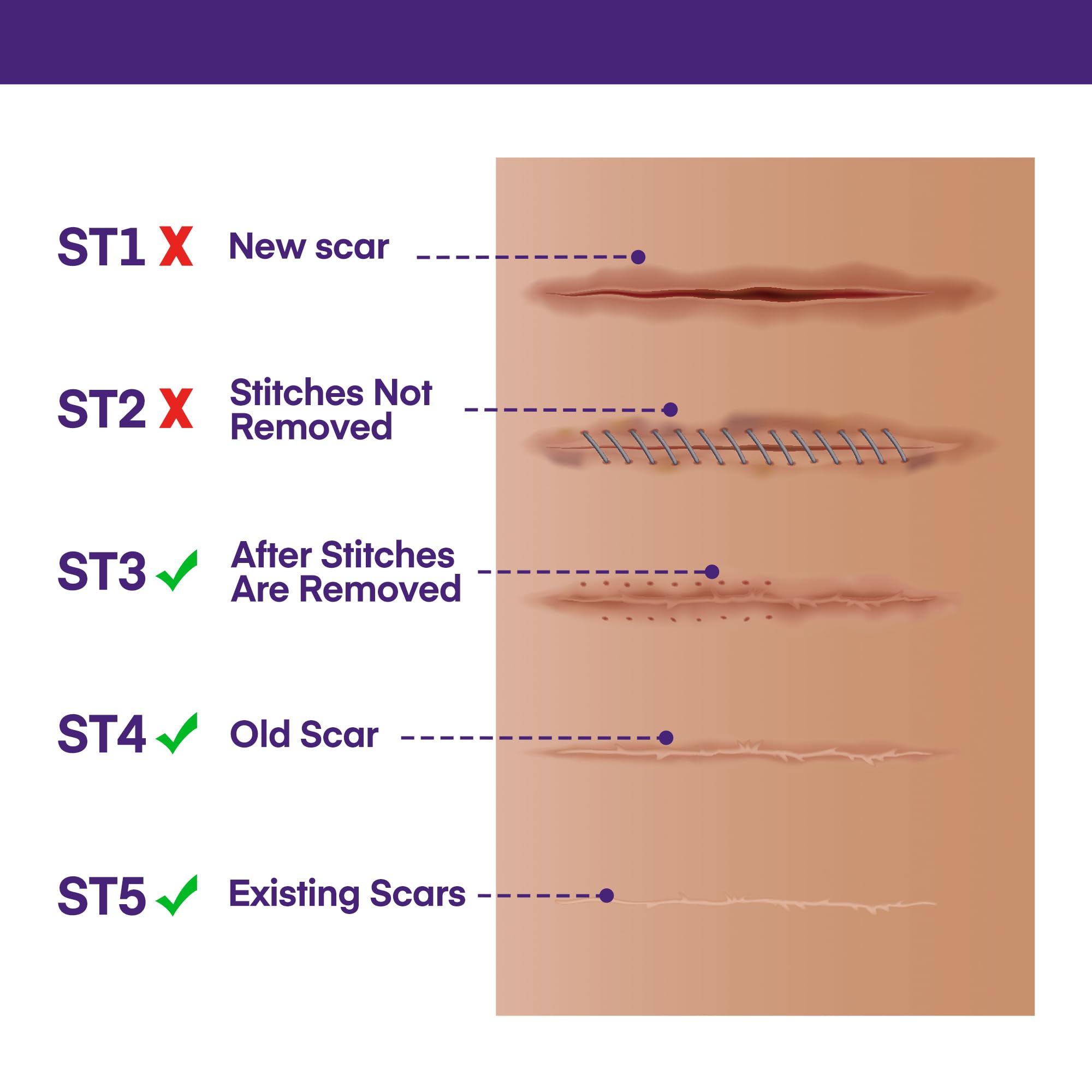 MURASAKI BEAUTY silicone scar gel close-up texture for even application.