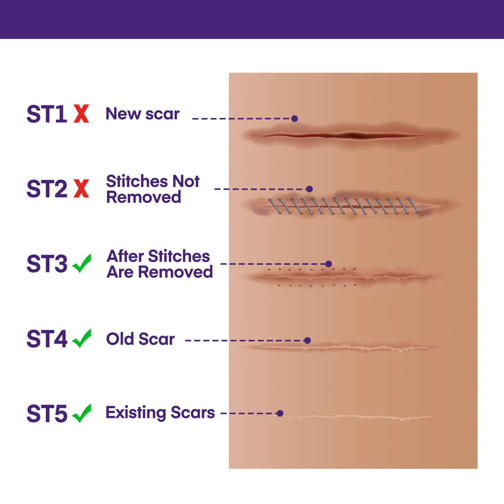 MURASAKI BEAUTY silicone scar gel close-up texture for even application.