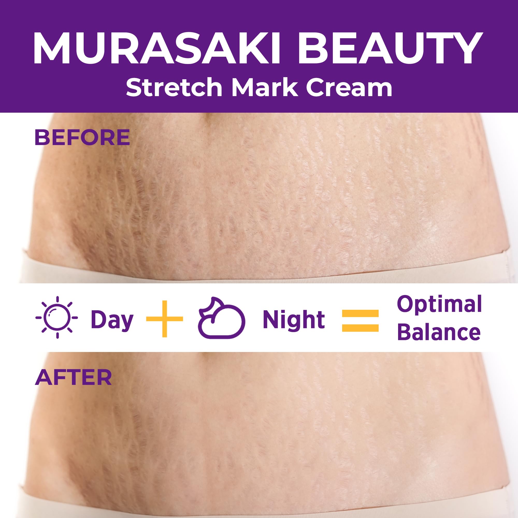 Murasaki Beauty stretch mark cream texture close-up showing fast-absorbing formula