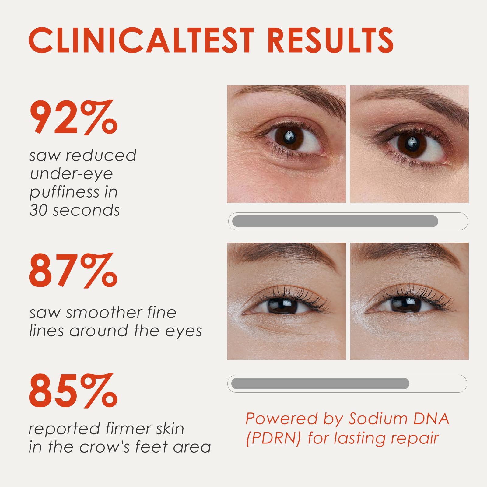 Muxmrx 30S skin portrait shows fragrance-free, gentle under-eye care.