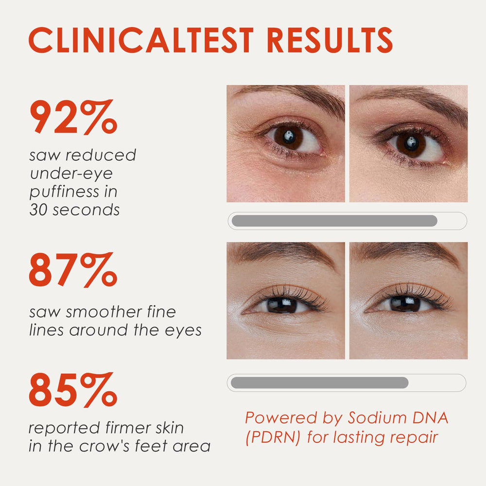 Muxmrx 30S skin portrait shows fragrance-free, gentle under-eye care.