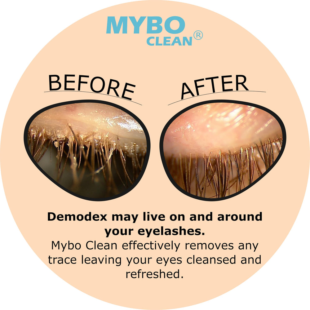 Myboclean coconut oil ingredient shot showcases moisturizing nourishing benefits.