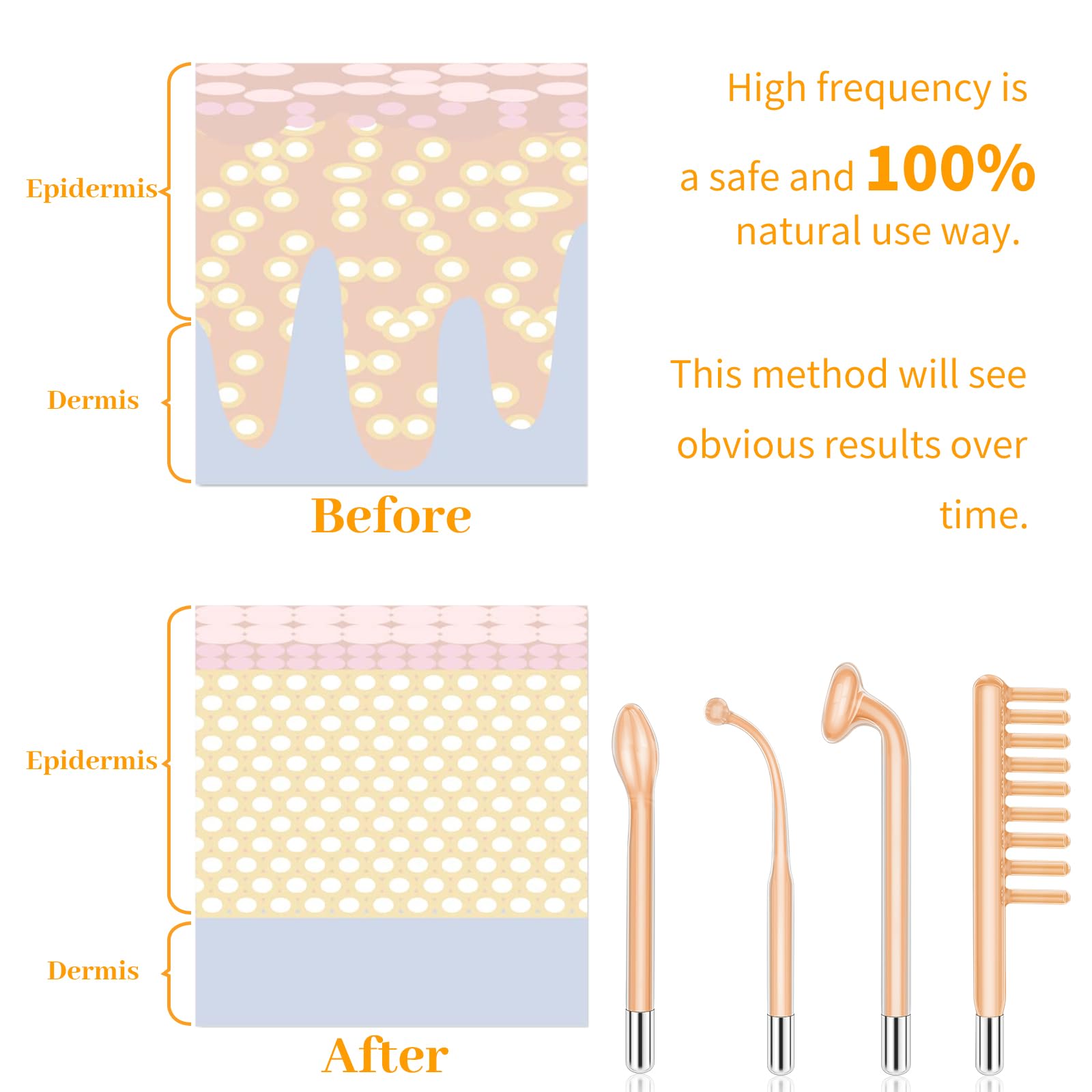 MYSWEETY high-frequency wand charging image highlights cordless convenience