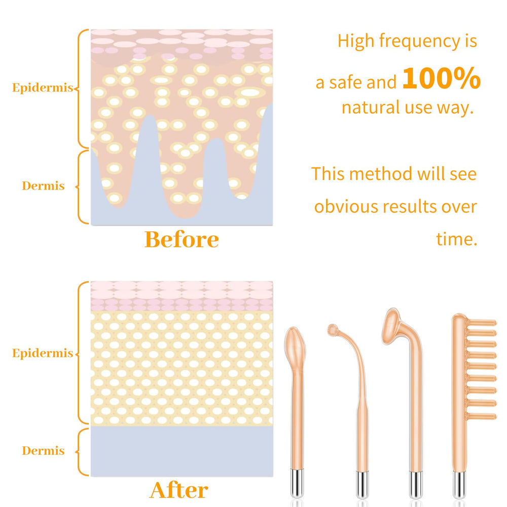 MYSWEETY high-frequency wand charging image highlights cordless convenience