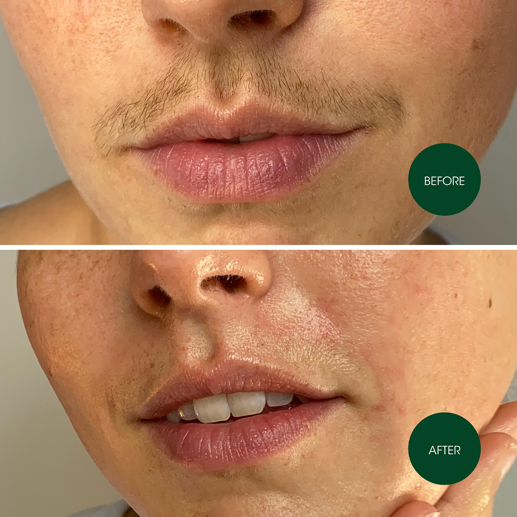 Nad's strip on upper lip in application delivering smooth results