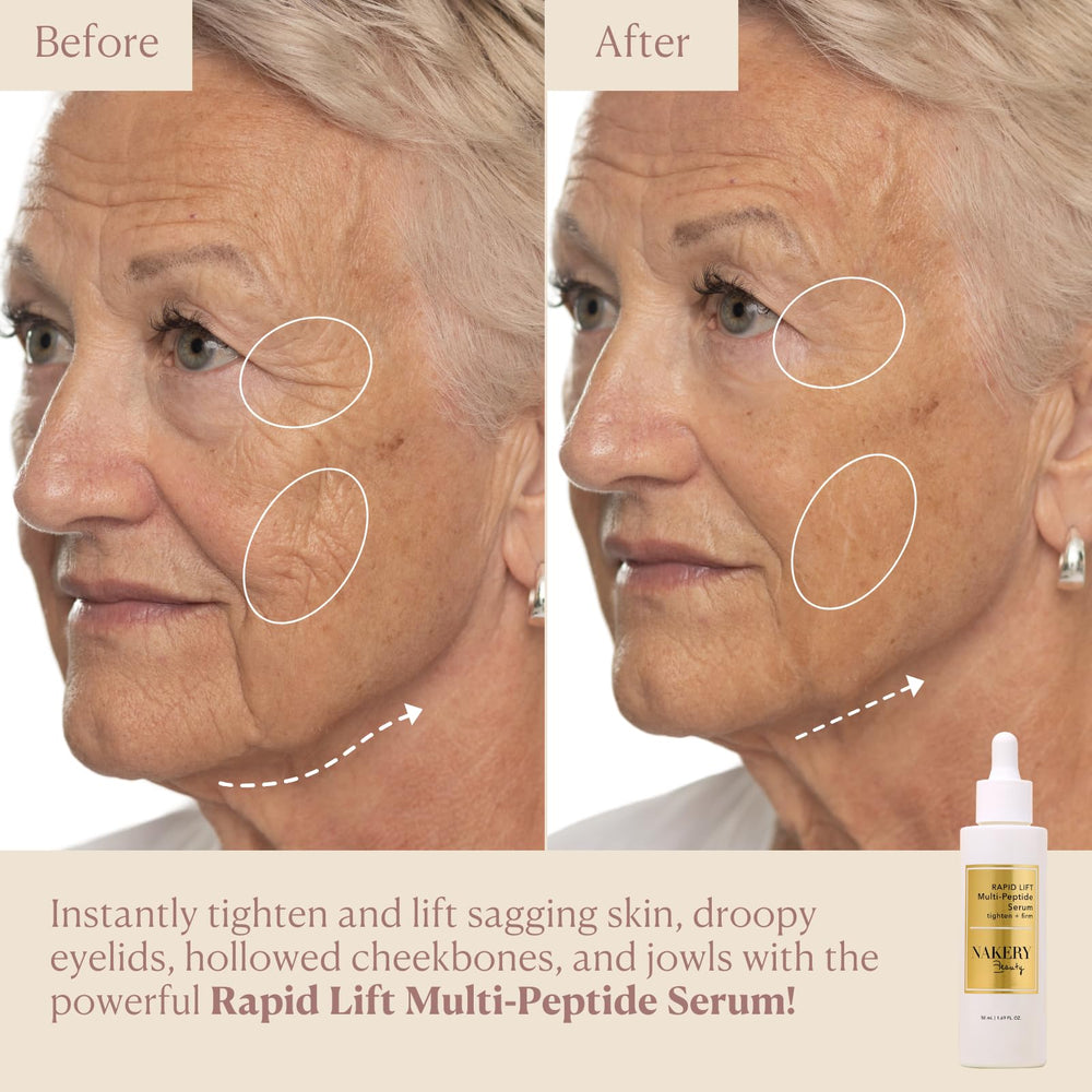 Nakery skin tightening appearance close-up showing improved contour