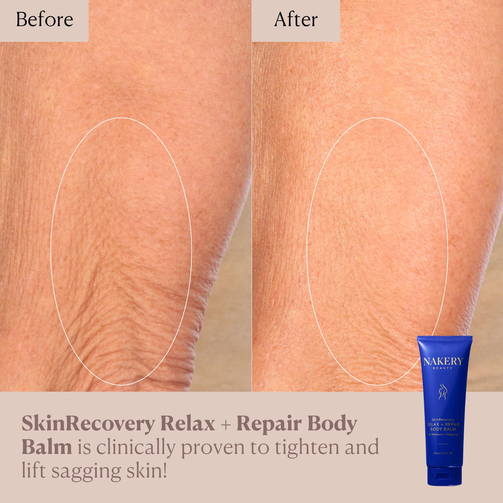 Nakery SkinRecovery extremely dry skin spot after bath shows deep hydration.