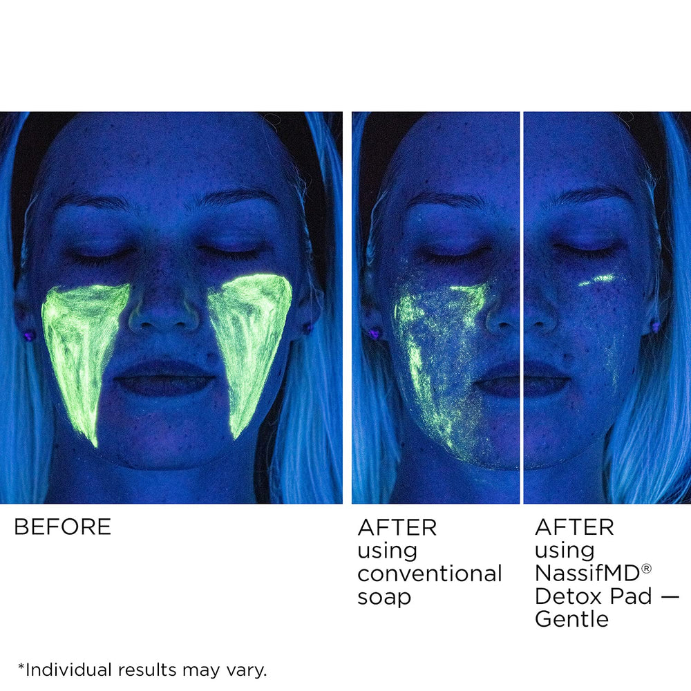 NassifMD Gentle Detox Pads lemon scent and aloe vera aroma refresh routine.