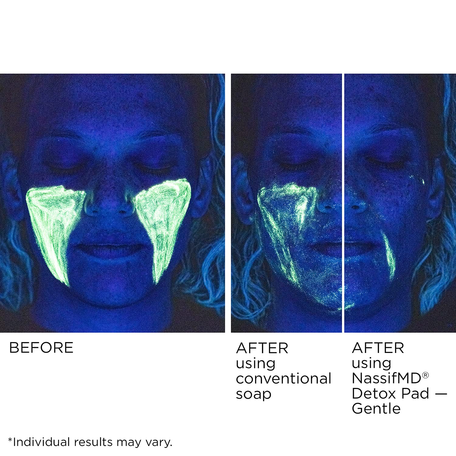 NassifMD Gentle Detox Pads moisturize skin with hyaluronic acid for smoother feel.
