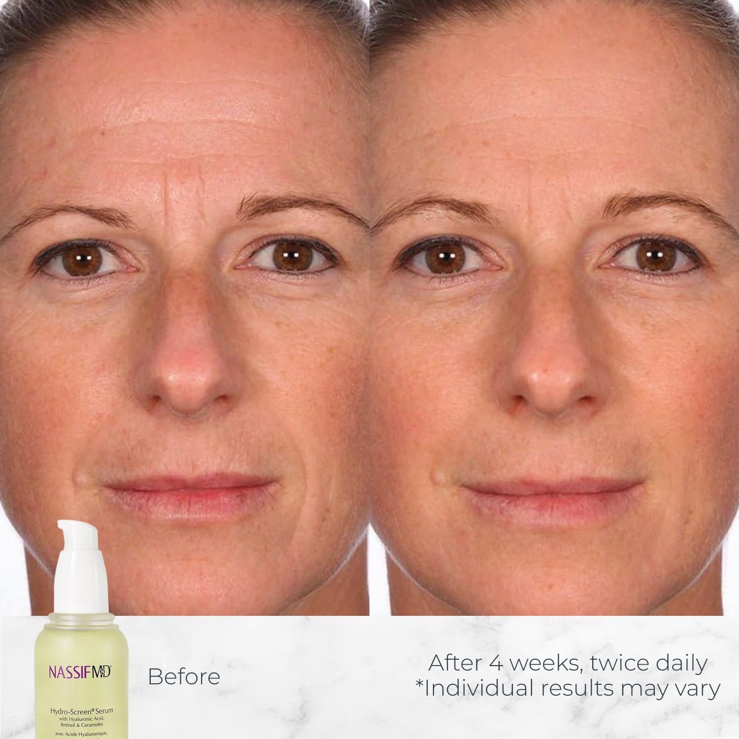 NassifMD Hydro-Screen Serum swirl on skin shows a silky, non-greasy finish.