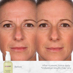 NassifMD Hydro-Screen Serum swirl on skin shows a silky, non-greasy finish.