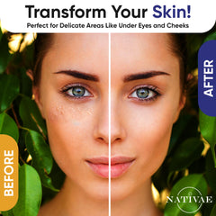 Nativae Milia Remover nose area image highlights precise spot treatment.