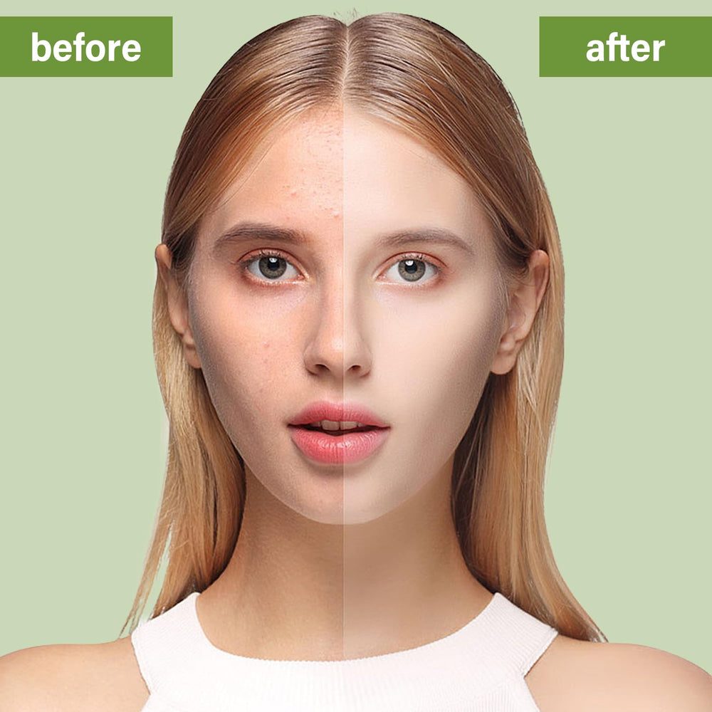 Natura Derm Tea Tree Soap packaging shows compact, easy-to-store format.